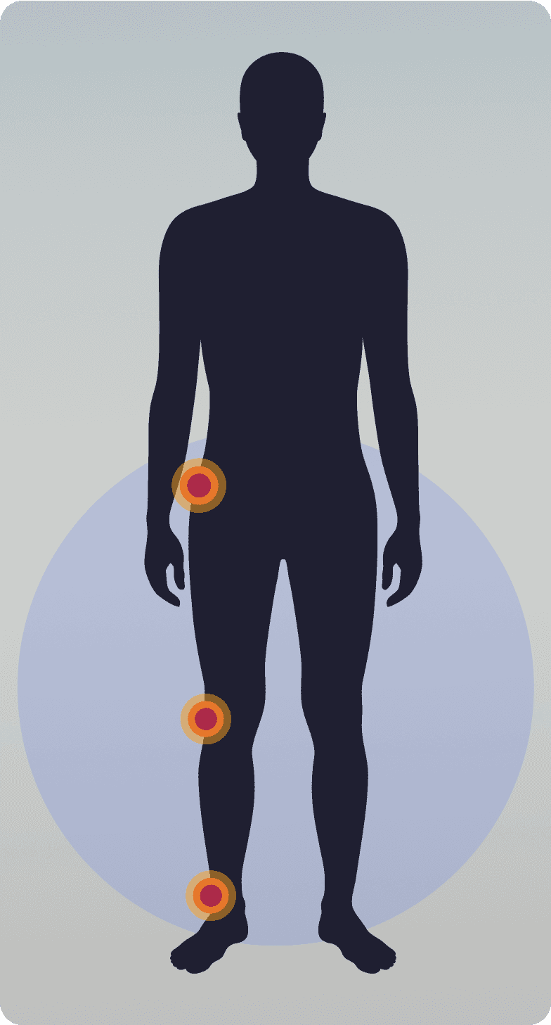 silhouette of the human body highlighting areas where tgcts can occur such as hips, knees, and ankles